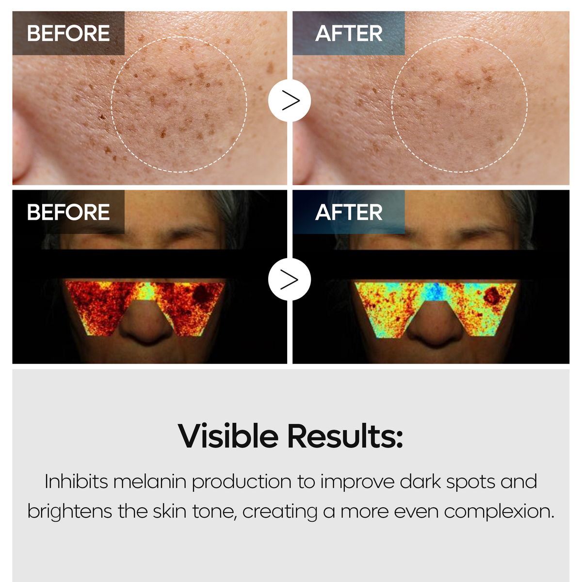 TX Tranexamic Acid Dark Spot Tone Care Line