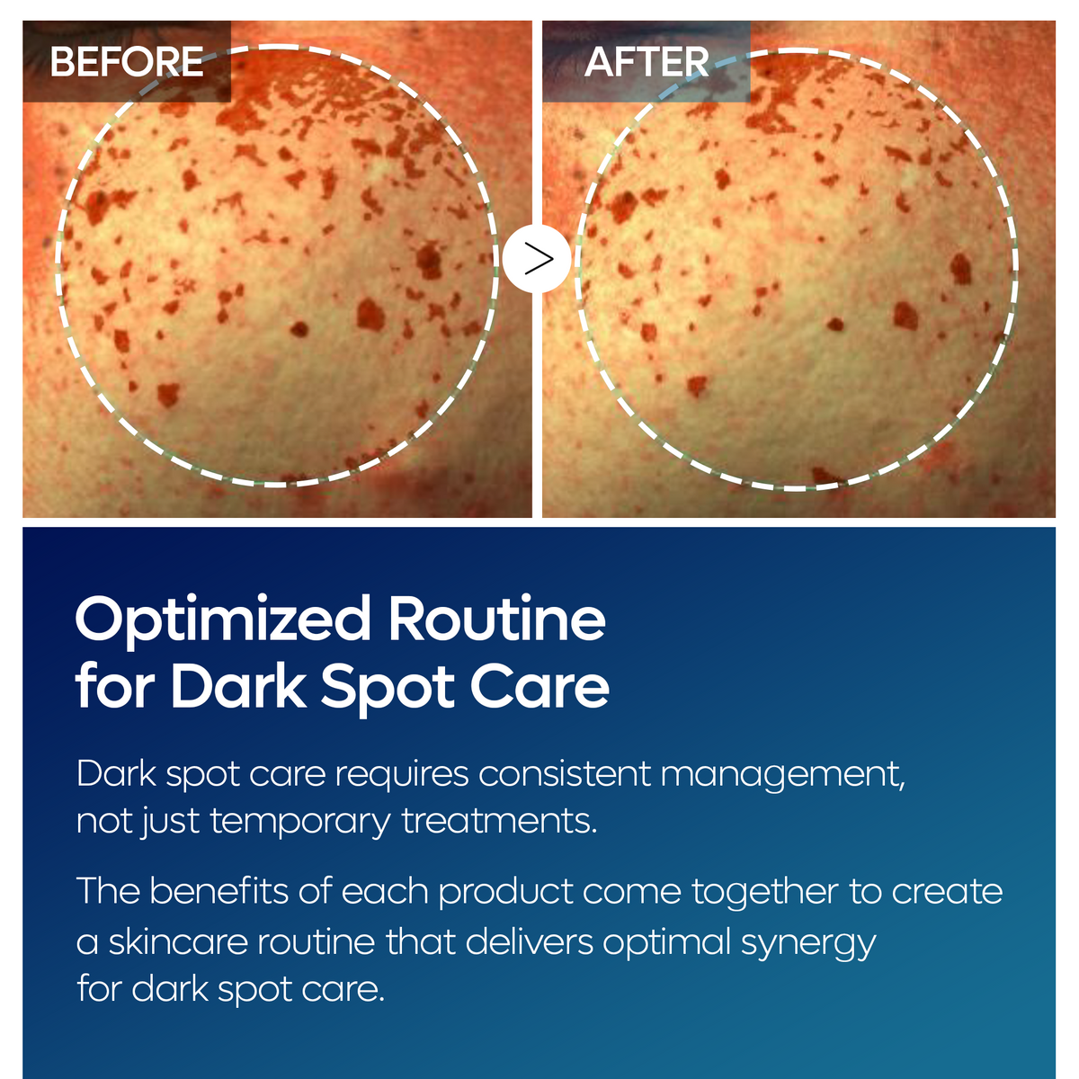 TX Tranexamic Acid Dark Spot Tone Care Line