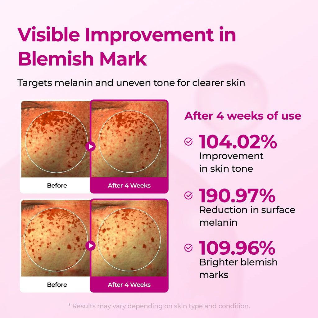 Glass Skin System™